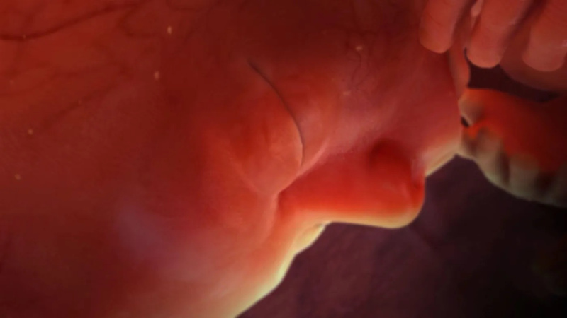 2 fight for life