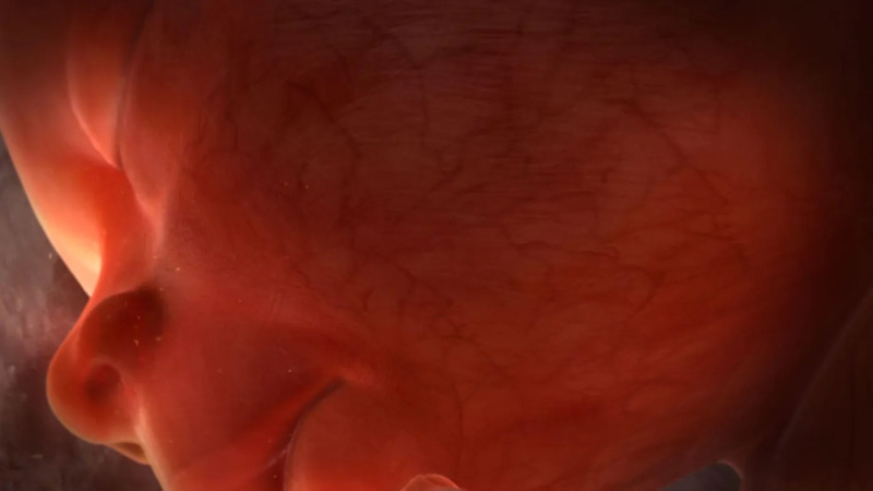 3 fight for life
